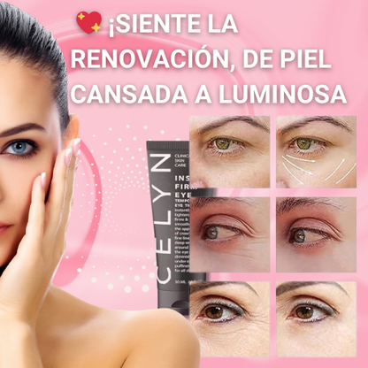 Celyn: Crema Rejuvenecedora para Ojos