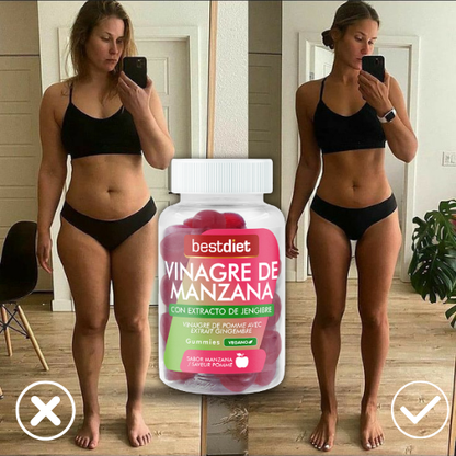 Gummies de Vinagre de Manzana – Apoyo Digestivo y Energía Natural