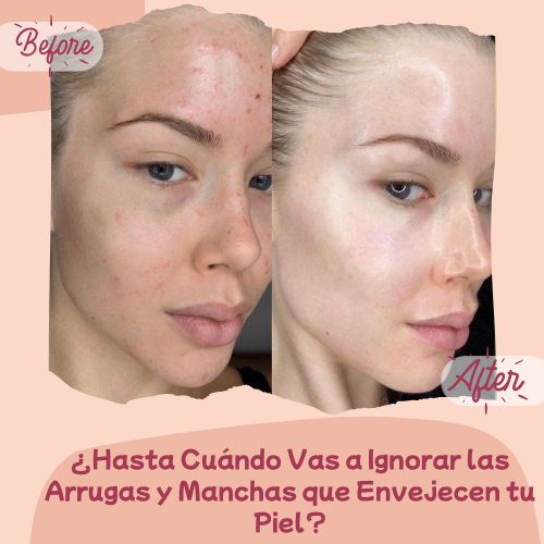 NK Sérum+ RODILLO DE REGALO- Reafirma, Hidrata y Revitaliza tu Piel.