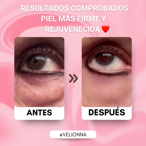 Celyn: Crema Rejuvenecedora para Ojos